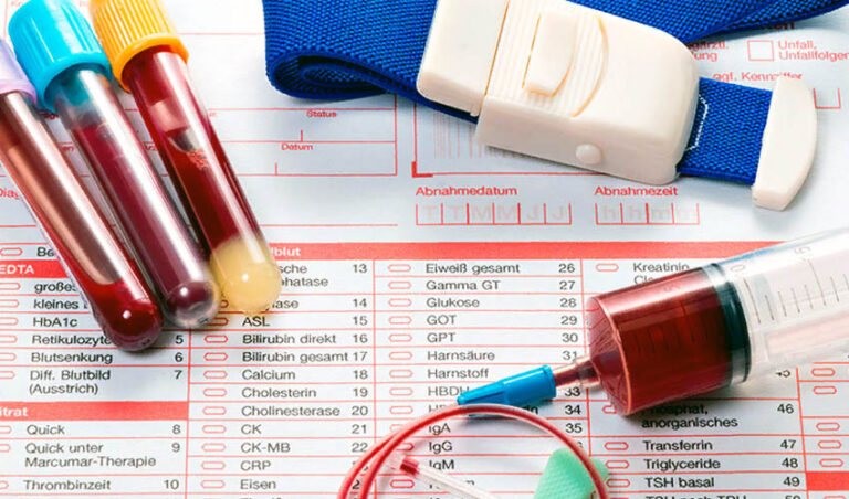 Общие правила подготовки к анализам крови